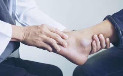 Should I See a Doctor About My Sprained Ankle?