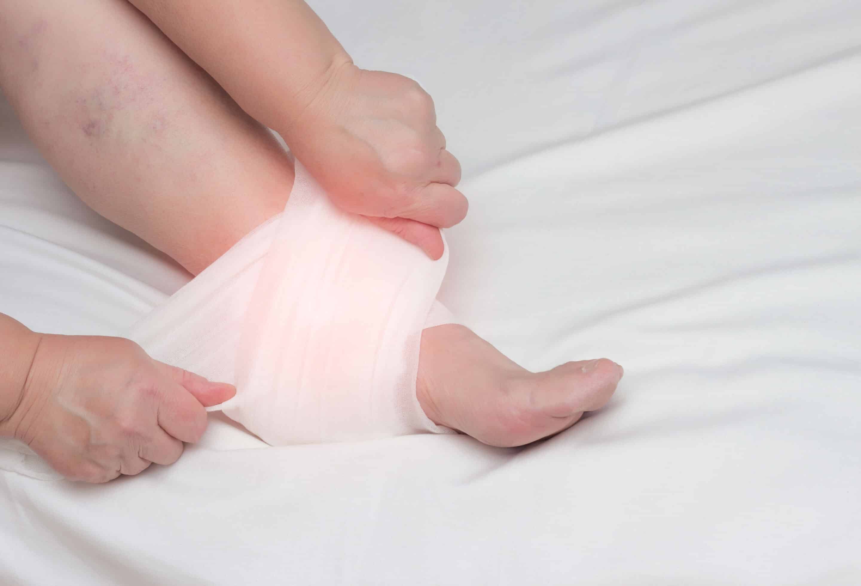 Adult woman fixes a compress on the heel spur to relieve inflammation
